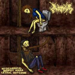 Inopexia : Myocardical Biopsy Had a Lethal Outcome